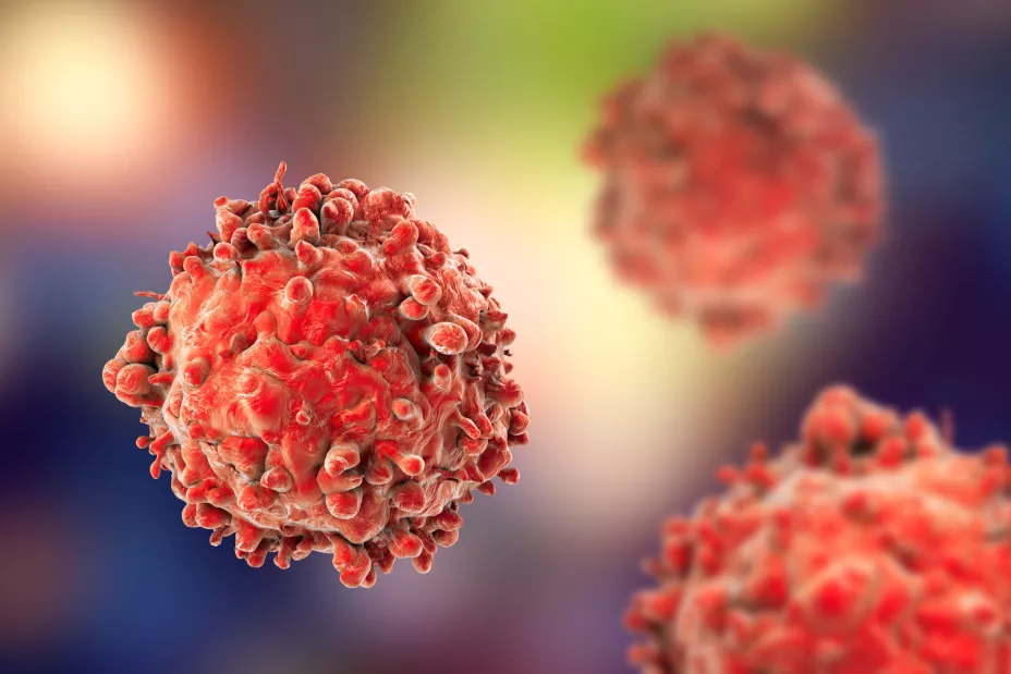 Cáncer sangre l-Kateryna Kon.jpg