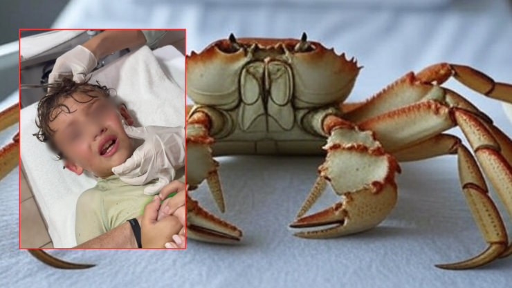 Niño se le mete cangrejo