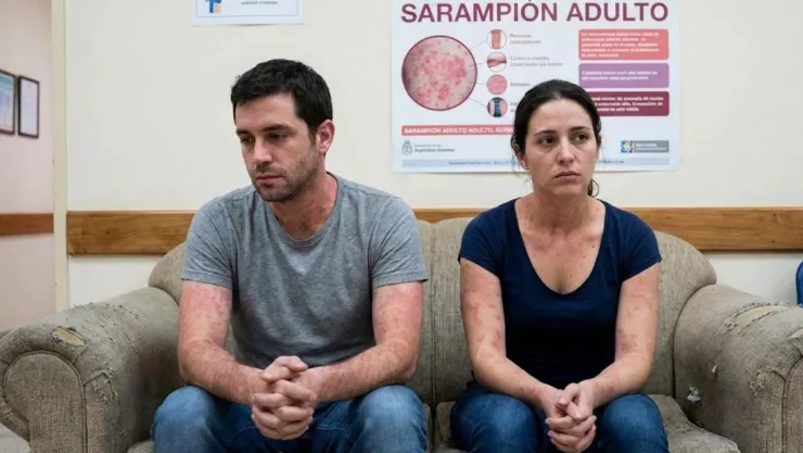 Sarampión México 2026: Por qué los nacidos en los 90 están en riesgo