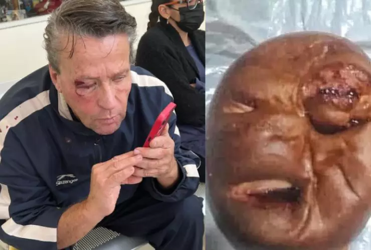 Crean pan del rostro lastimado de Alfredo Adame