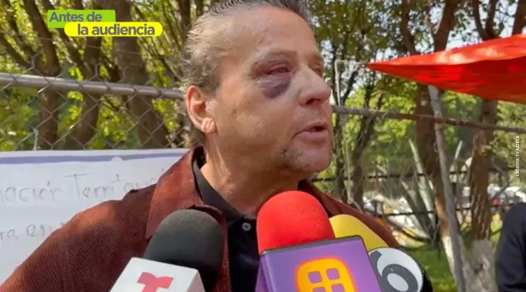 Alfredo Adame asegura que podría perder el ojo tras golpiza.