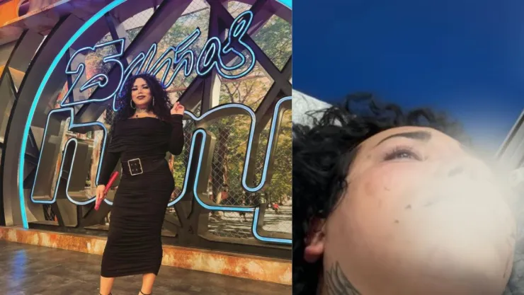 Famosa influencer es brutalmente golpeada presuntamente por su novio