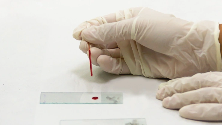 sangre covid-19 prueba