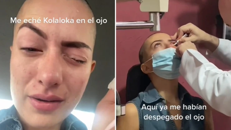 tiktoker_pegamento_ojo