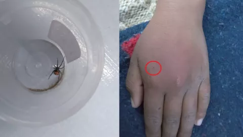 Niño se deja picar por viuda negra para ser Spider-Man