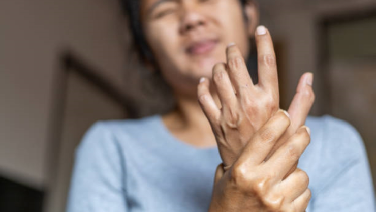 deformación de las manos.jpg