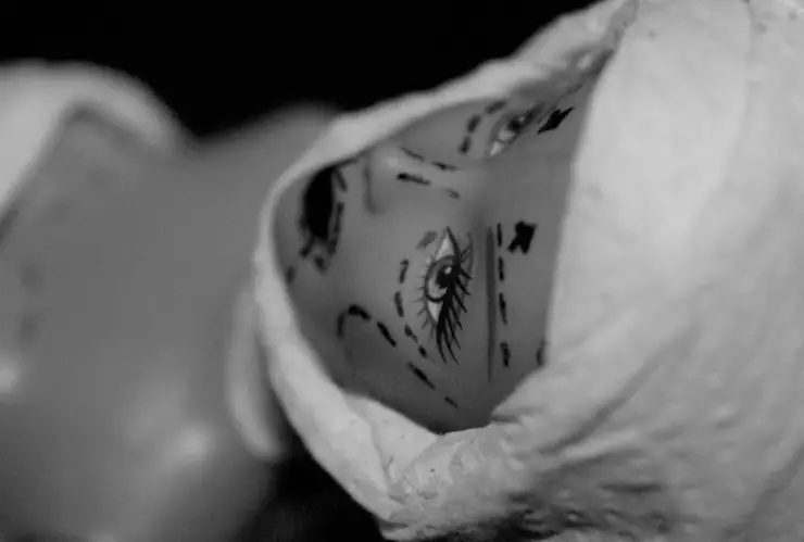 Mujer muere al realizarse 6 CIRUGÍAS estéticas en 24 HORAS; así ocurrió