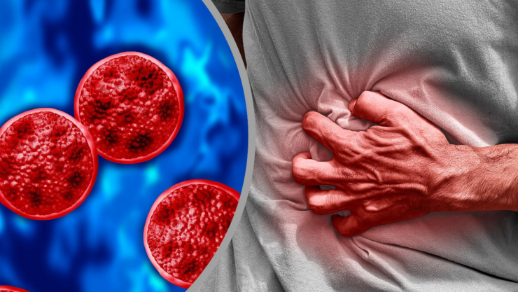 Brote de ciclosporiasis síntomas del parásito en frutas y verduras contaminadas