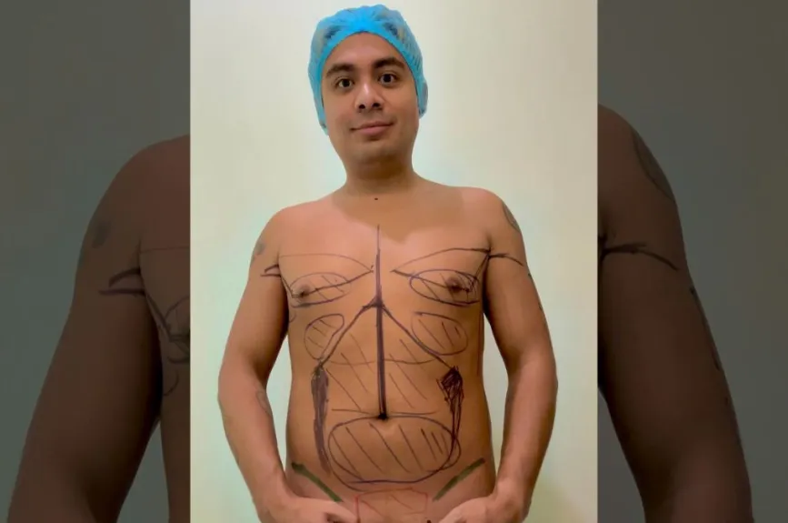 ricardo lipo.jpg