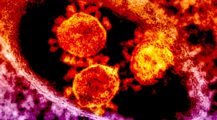 Vibrio vulnificus