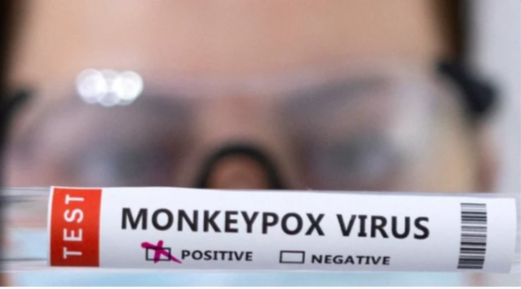 Nueva variante de mpox