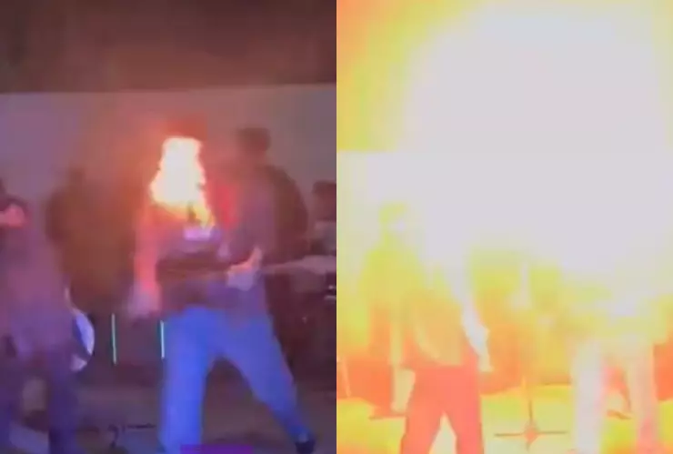 VIDEO | Joven intenta truco con fuego y sufre quemaduras en la boca