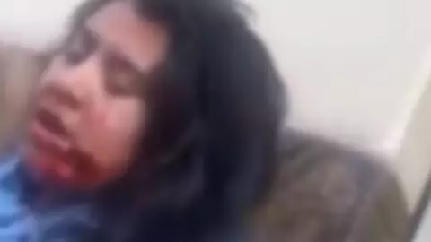 Mujer arranca cachete