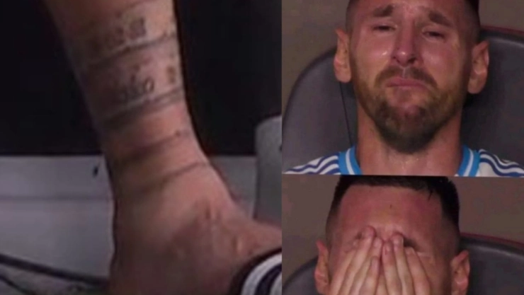 Imágenes de Lionel Messi en lágrimas y su tobillo lesionado en la Copa América