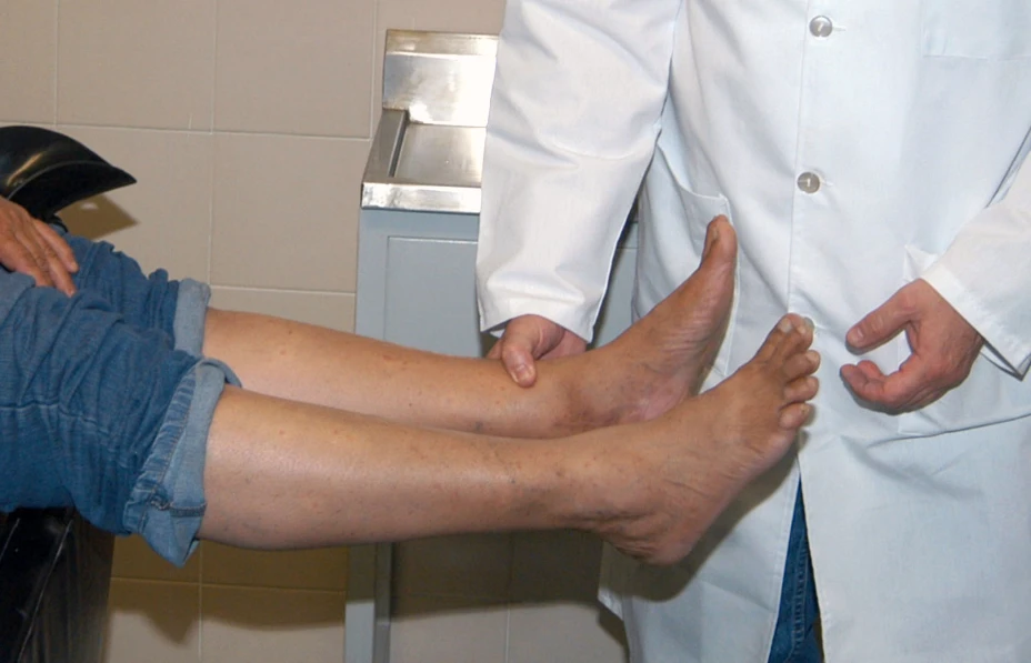 Evitar hongos en pies