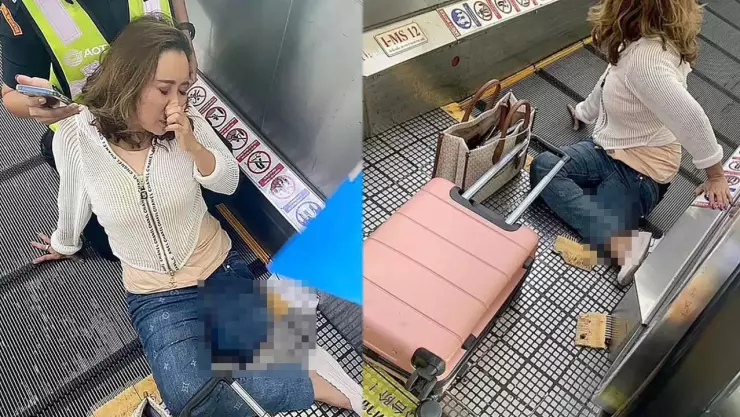 Turista perdió su pierna en la cinta transportadora del aeropuerto