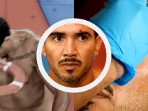 ¿Fue muy grave? Así fue el accidente que sufrió “El Mono” Osuna antes de entrar a La Granja VIP
