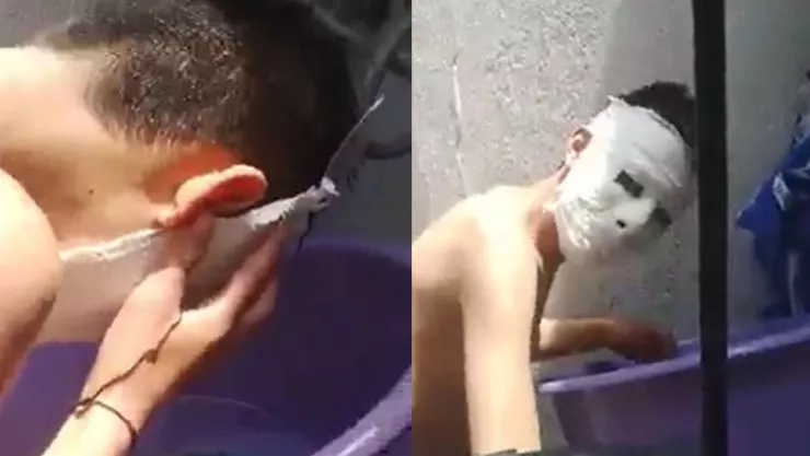 VIDEO: Alumno hace máscara de yeso y se le queda pegada.