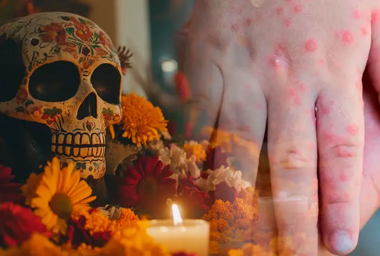 Suspenden Festejos de Día de Muertos en la Sierra de Oaxaca por Brote del Virus Coxsackie