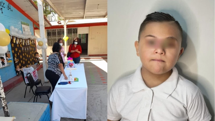 discriminacion_nino_sindrome_de_down