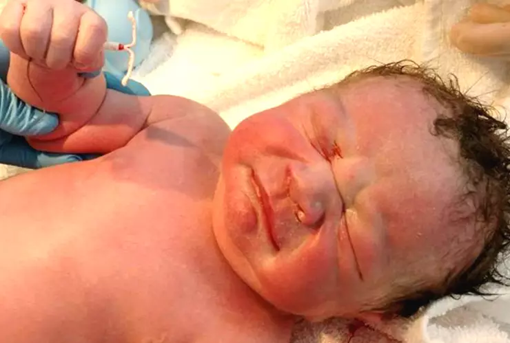 diu bebé texas embarazo inesperado