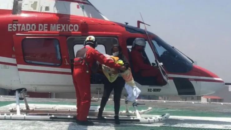 TRASLADO BEBÉ CON QUEMADURAS.jpeg