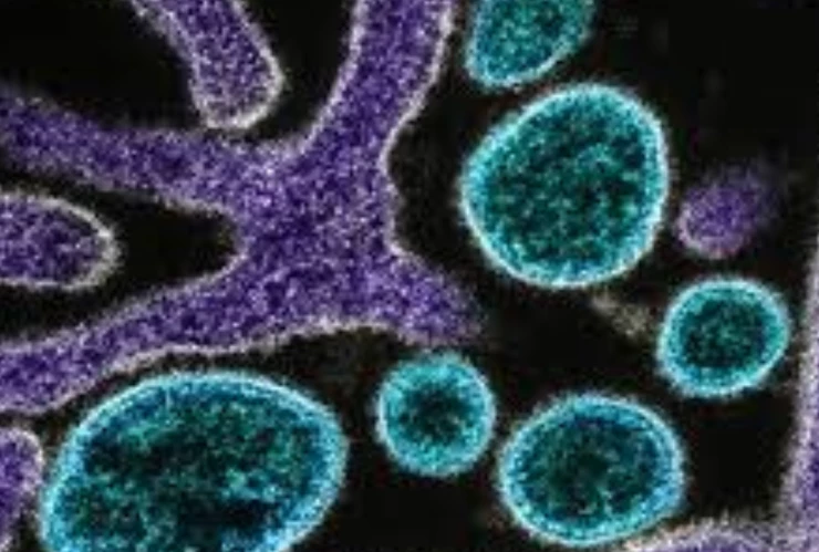 Virus Nipah