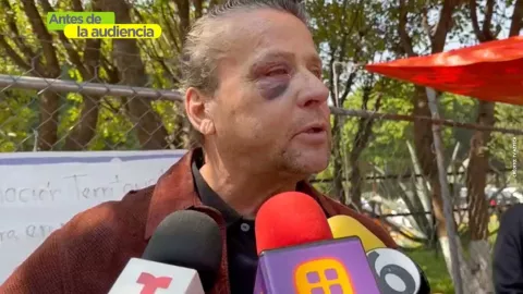 Alfredo Adame asegura que podría perder el ojo tras golpiza.