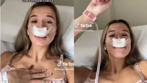 Mujer se hace rinoplastia para que sus hijos nazcan con bonita nariz
