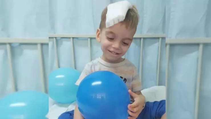 El pequeño Oliver se recupera, le extirparon el 90% del tumor cerebral