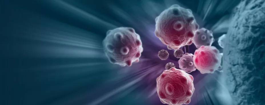 Quimioterapia flow unnamed .jpg