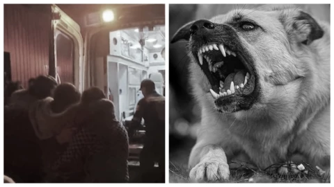 Mujer sufre destrozo de pantorrilla al ser atacada ferozmente por un perro en Puebla | VIDEO