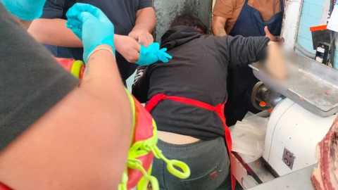 Accidente trabajadora carnicería CDMX
