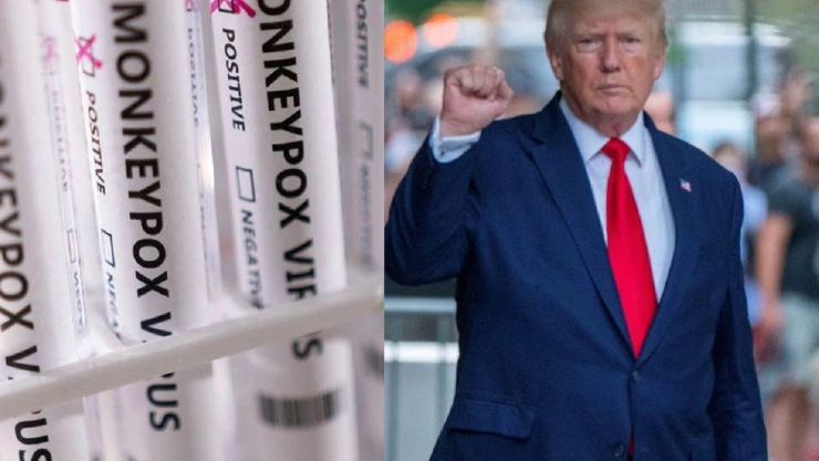 Proponen “TRUMP - 22" como nuevo nombre de la viruela del mono
