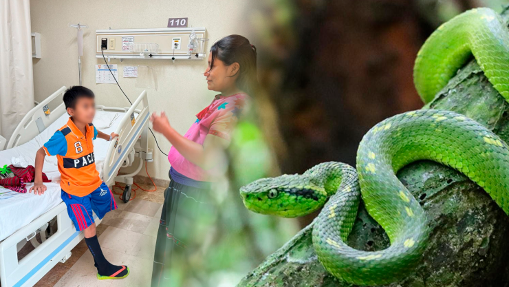 Niño pierde la pierna por serpiente