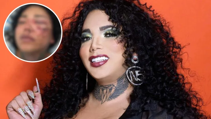 Paolita Suárez sufre golpiza de su novio