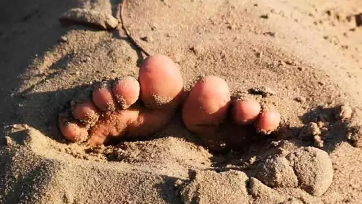 ¿Qué pasó en Australia? Joven muere al ser enterrado en la arena por accidente
