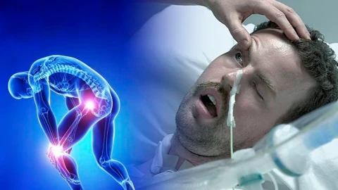 Síndrome de Guillain Barré