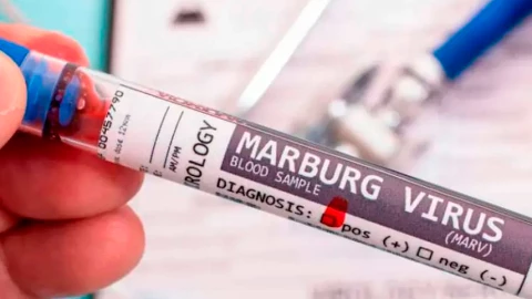 OMS confirma brote de Marburgo en Etiopía