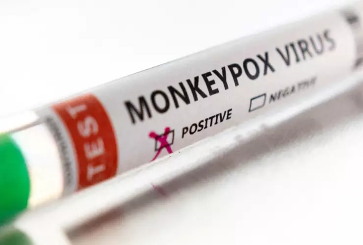 viruela del mono México primer caso