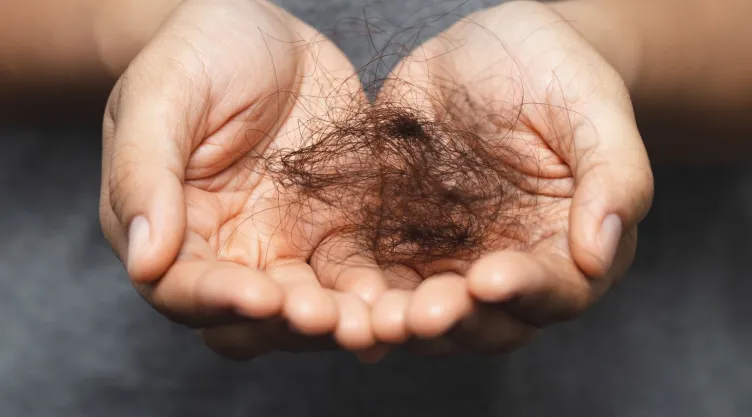 Evita la caída del cabello con ayuda de la semilla de aguacate