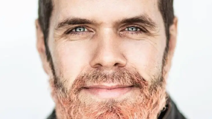 Vlogguer Pérez Hilton se graba autolesionandose.