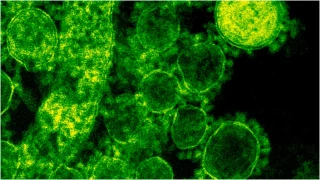 ¿Puede llegar a Aguascalientes_ Esta es la explicación sobre la viruela del mono y sus síntomas