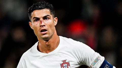 Cristiano Ronaldo sufre golpe