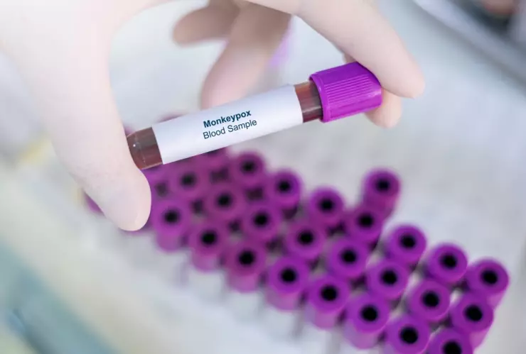 Qué significa que la cepa de viruela del mono tenga “potencial pandémico”