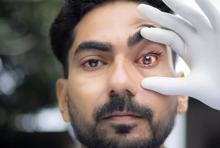 Cirugía de diente en el ojo puede devolver la vista a pacientes