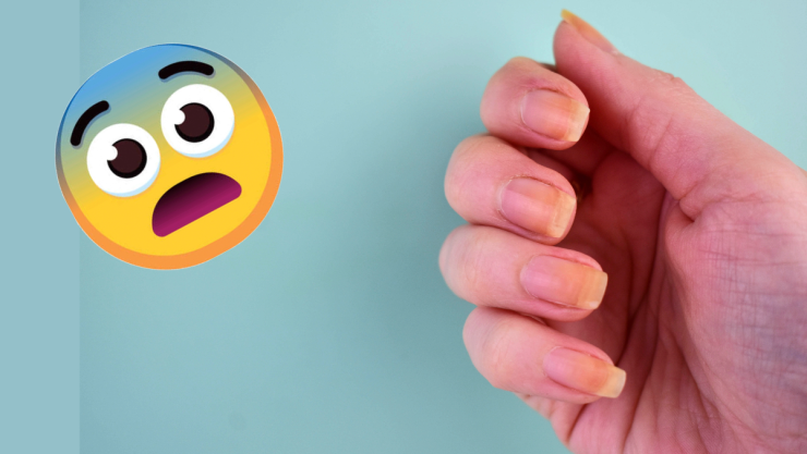 ¿Cómo quitar lo amarillo de las uñas?.jpeg