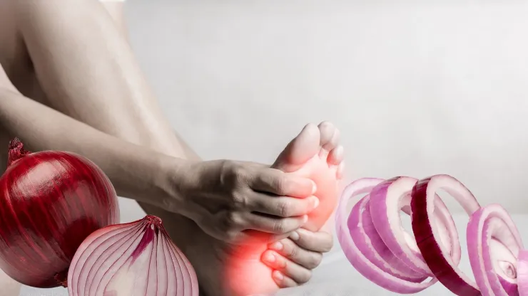 Rodajas de cebolla en los pies: El truco viral que muchos usan para aliviar malestares
