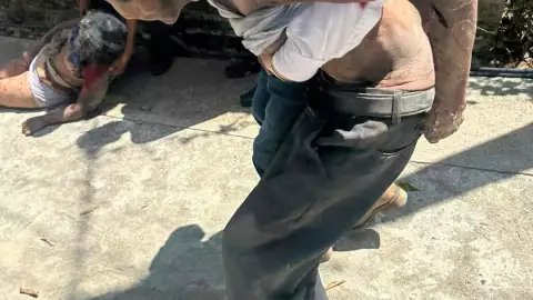 Explosion Polvorin Hidalgo heridos