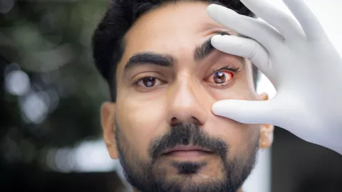 Cirugía de diente en el ojo puede devolver la vista a pacientes